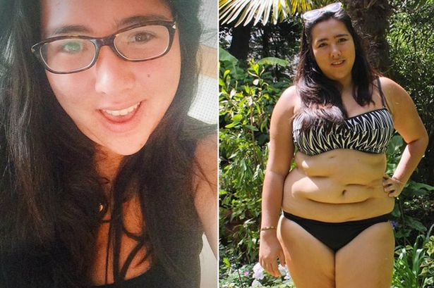 Curajul incredibil al tinerei care a trecut prin 15 operatii pentru a isi salva viata: "Am acceptat felul in care arat"