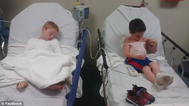 Arsurile ingrozitoare cu care s-au ales doi frati dupa o vizita la piscina. Ingrijitorii lor spun ca au ramas fara crema