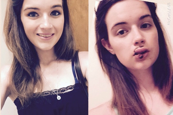 O tanara de 17 ani din Louisiana, atacata de mai multi barbati. Motivul incredibil pentru care au lasat-o desfigurata