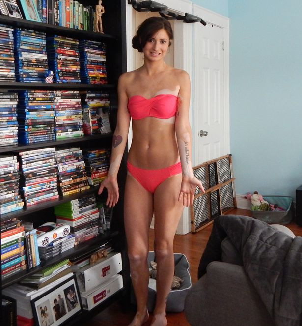 Era poreclita "dalmatianul" si era tinta glumelor rautacioase ale colegilor. Ce s-a intamplat dupa ce si-a facut un tatuaj