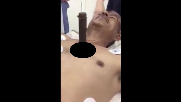 Imagini uluitoare. Un barbat cu un cutit urias infipt in piept vorbeste cu medicii pe patul de spital. VIDEO