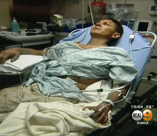 A vrut sa faca o poza cu un sarpe cu clopotei, iar acum risca sa-si piarda o mana. Ce se intampla cu pielea barbatului. VIDEO