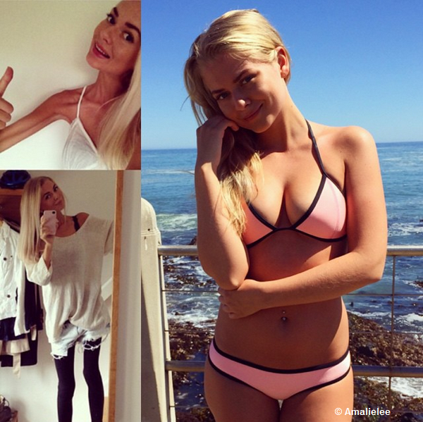 La 17 ani a devenit anorexica din cauza unei depresii. Cum arata acum tanara care se mandreste cu formele ei pe Instagram