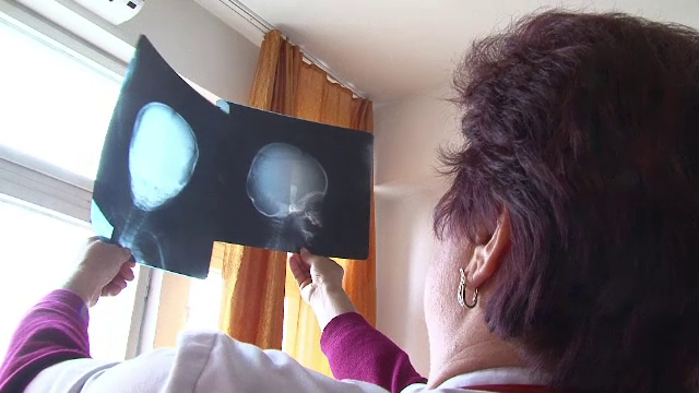 La doar 2 luni, un copil a ajuns la spitalul din Craiova A DOUA OARA, cu urme de violenta. Cine ar putea fi agresorul