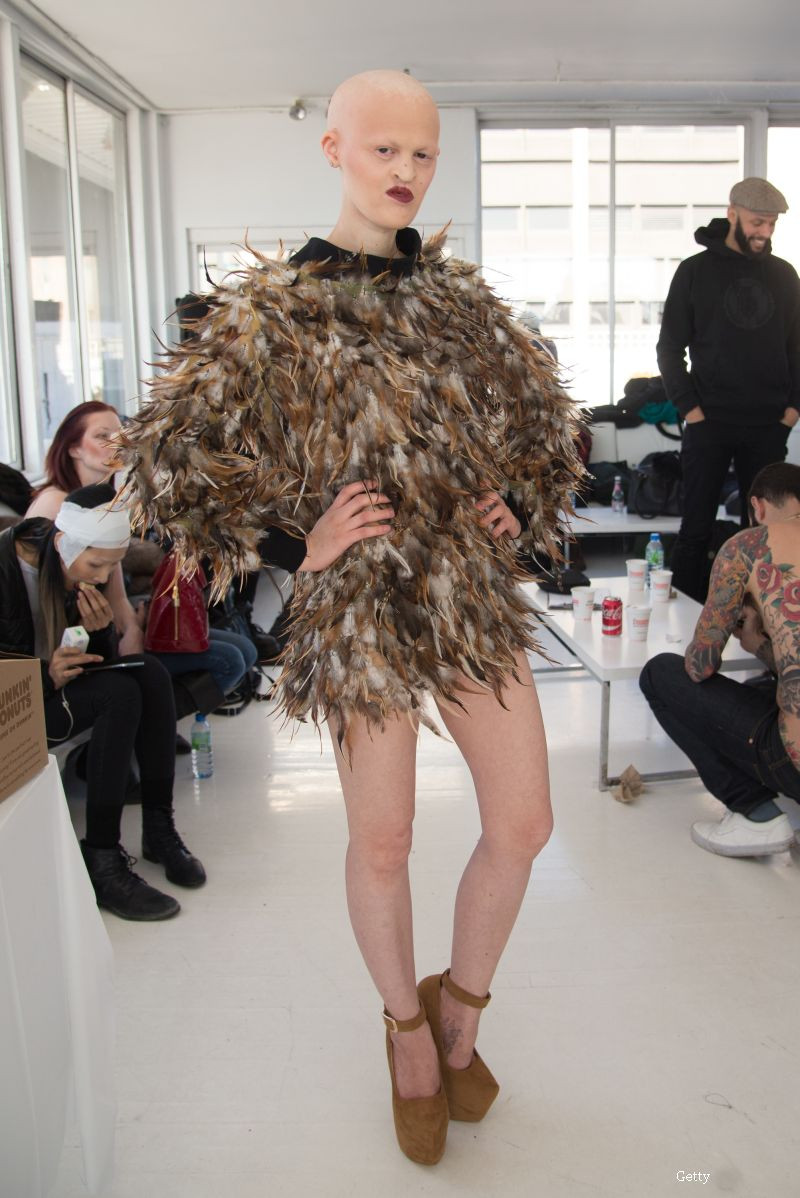 S-a nascut fara dinti, fara par si partial oarba. Cum a ajuns aceasta fata una din cele mai bine cotate modele