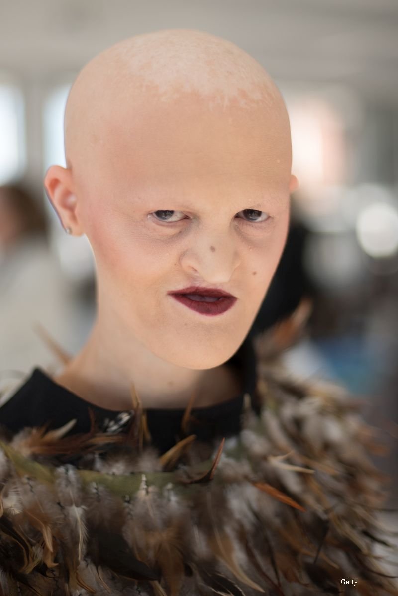model