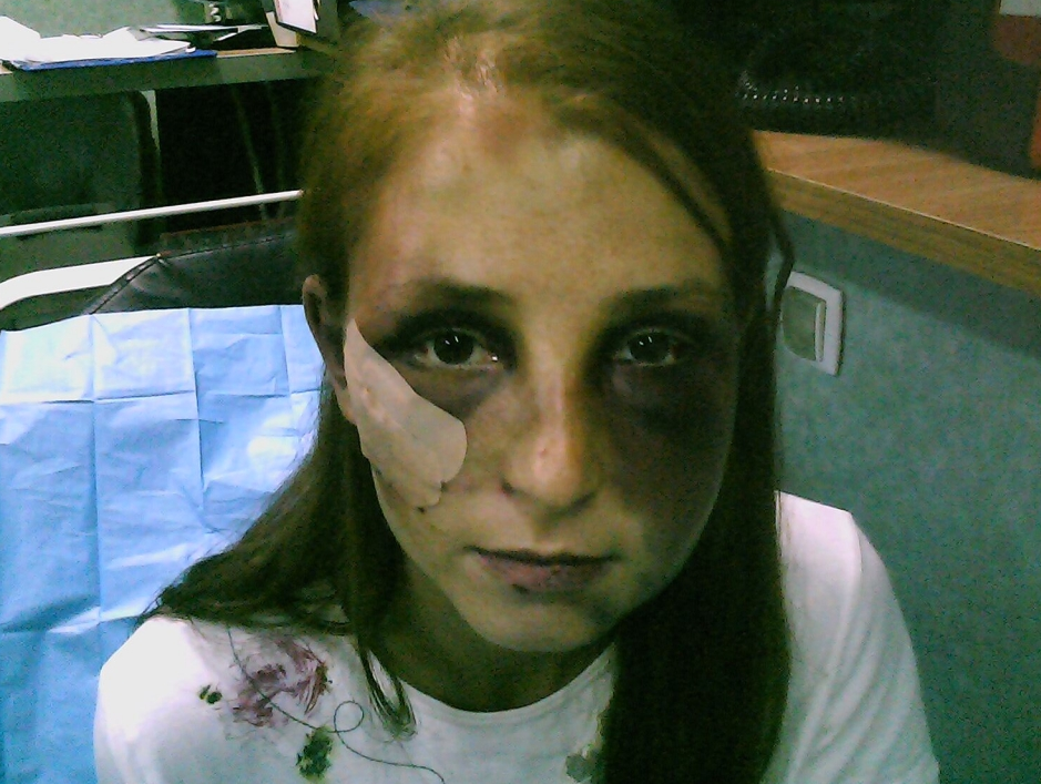 Tanara din Lugoj, sechestrata 22 de ore si batuta cu brutalitate de iubitul gelos, care i-a rupt trei coaste. VIDEO