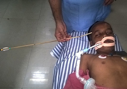 O sageata i-a strapuns capul unui baiat de 11 ani, la scoala. Cum s-a petrecut totul. FOTO