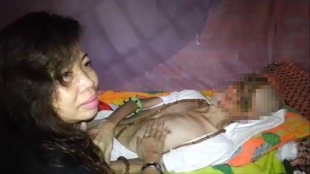 Cazul cutremurator al unui barbat din Vietnam, care nu mai are nas, ochi si obraji din cauza unei boli misterioase. VIDEO