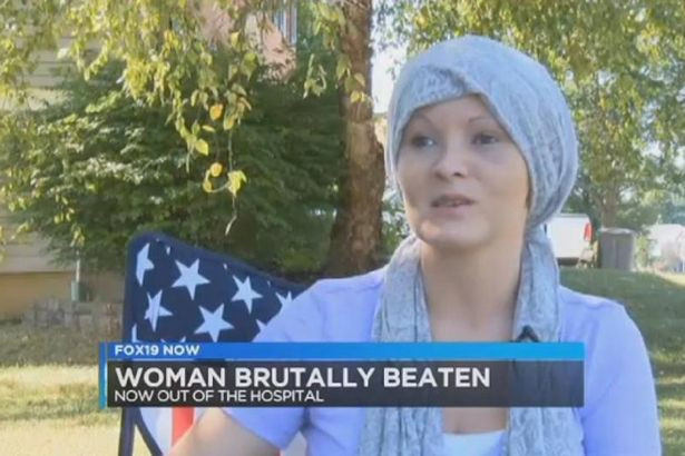 S-a enervat pe iubita lui din cauza unei postari pe Facebook si si-a asmutit cainele asupra ei. Au urmat clipe de groaza