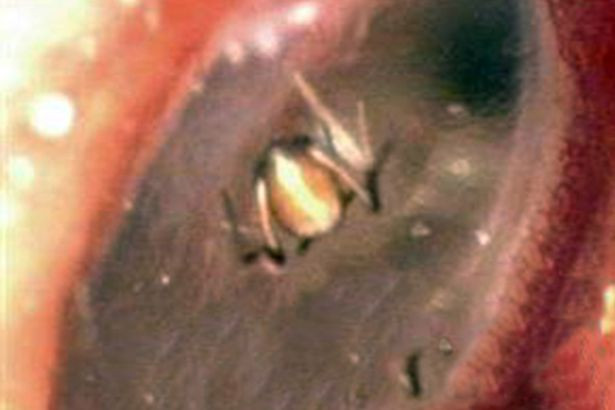 A crezut ca este posedata de spirite malefice pentru ca a mancat zmeura de pe un mormant. Ce se intampla, de fapt, cu tanara