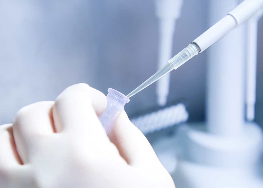 Experimentul neaprobat al unui om de stiinta din Rusia. Ce s-a intamplat cu el dupa ce si-a injectat o bacterie nemuritoare