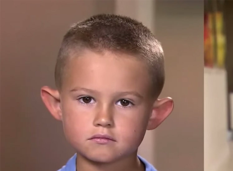 Copiii de la scoala il strigau "urechi de elf", iar parintii au decis sa-i faca operatie estetica. Cum arata acum baietelul