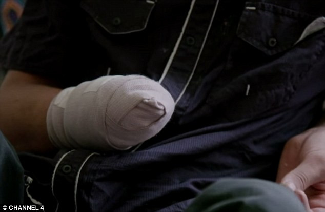 Drama unui baiat de 14 ani, schilodit de Statul Islamic. Motivul pentru care jihadistii i-au taiat o mana si un picior