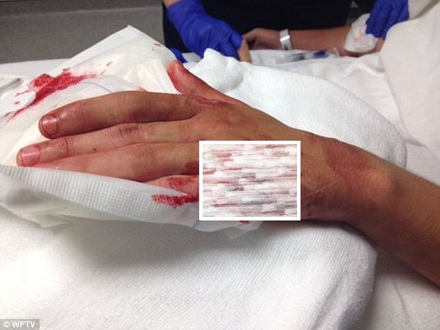 Un surfer de 14 ani, atacat de rechin pe coasta Floridei, la doar 100 de metri de mal. Cum a reusit sa scape