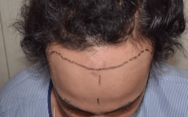 "Man bun-ul", o moda periculoasa? Afirmatia soc a unei specialiste si mitul creat in jurul sau. Bonus: Cum iti faci totusi cea mai tare coafura :)