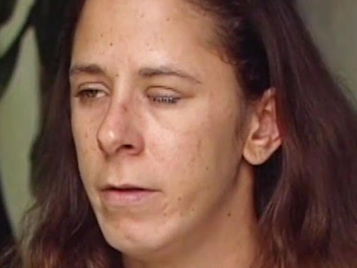 I-a pus lipici in ochi, dupa ce l-a confundat cu picaturile speciale. Ce a patit apoi o femeie timp de opt zile