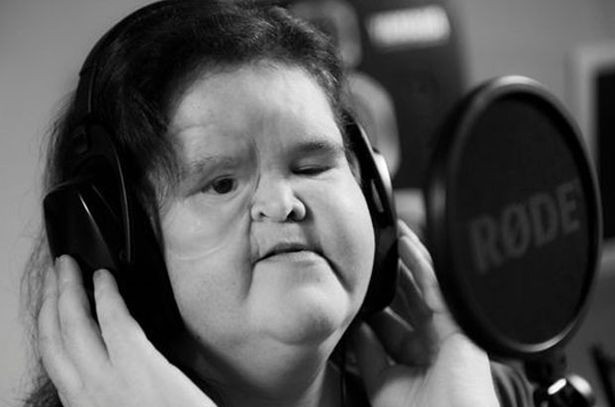 A supravietuit unui cancer care afecteaza 1 la 8 milioane de oameni. Chinul cumplit prin care a trecut apoi o britanica