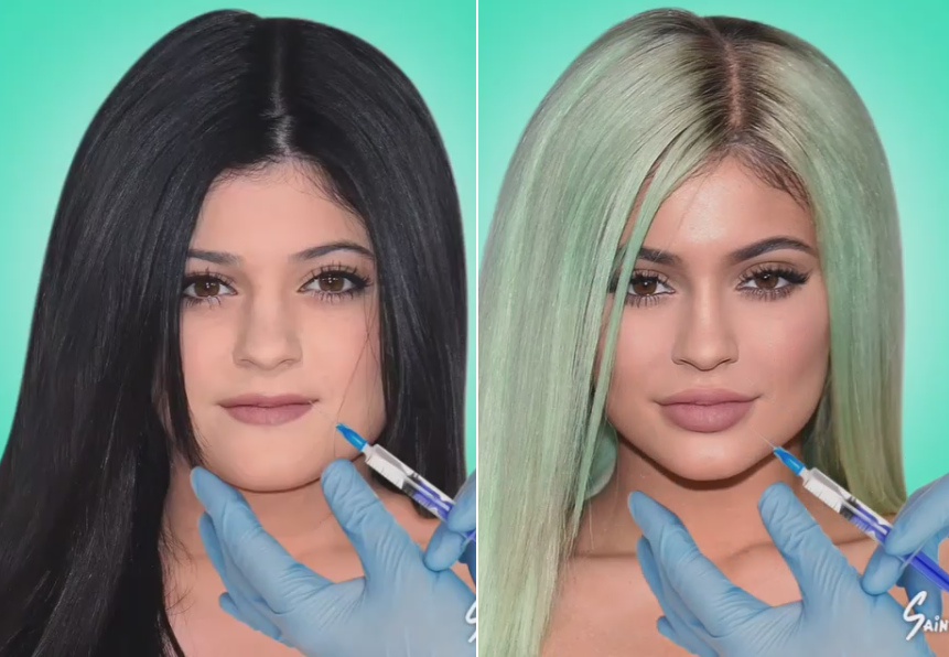 Nu recunosc ca si-au facut operatii estetice, dar diferentele sunt uriase. Surorile Kardashian, puse sub lupa de un grafician