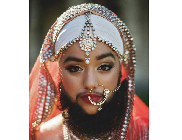 Are o boala care face sa-i creasca par pe fata. Drama pe care o traieste aceasta tanara zi de zi