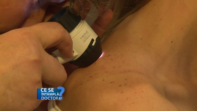 Ce poate insemna aparitia unor puncte rosii pe piele. Motivul pentru care trebuie neaparat sa mergeti la dermatolog