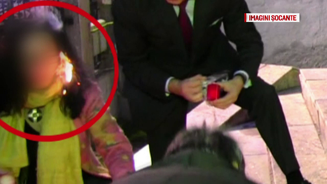 Incident la un eveniment de comemorare din Dej. O femeie s-a apropiat prea mult de o lumanare si i-a luat foc parul