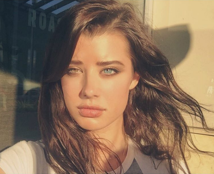 E unica si de o frumusete rapitoare, dar are un mic "defect". Modelul "imperfect" care a cucerit internetul cu farmecul sau