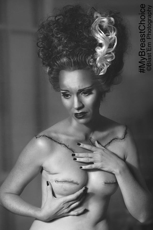 A supravietuit cancerului mamar si a dovedit ca poate fi in continuare atragatoare. Cum arata acum bustul acestei femei