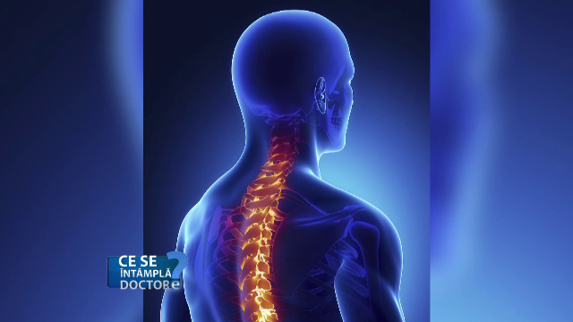 Ce poate ascunde o banala durere de cap. Motivul pentru care trebuie sa mergeti la medic daca aveti migrene dimineata