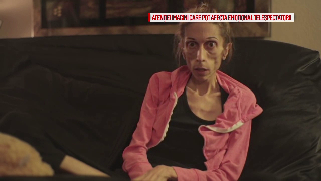 Acum sase luni, cantarea doar 20 de kilograme, iar astazi este de nerecunoscut, dupa tratament