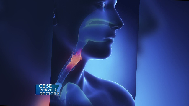 Cat de periculoasa este raguseala care persista mai multe saptamani. Iata de ce laringita acuta este o urgenta medicala