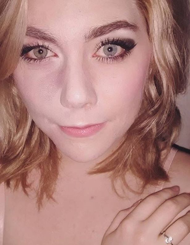 I s-a spus ca nu va fi iubita niciodata din cauza unui semn de pe obraz. Cum arata tanara fara machiaj. FOTO