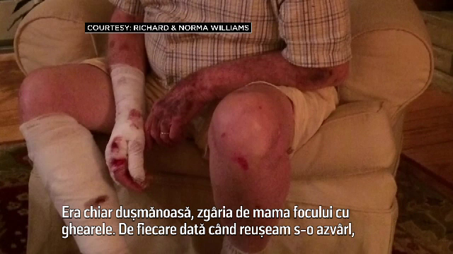 "Era chiar dusmanoasa". Povestea unui american care s-a luptat cu o veverita si a ajuns plin de sange la spital