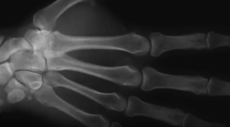 Ce se intampla cand iti pocnesti degetele. Oamenii de stiinta au dat verdictul: VIDEO