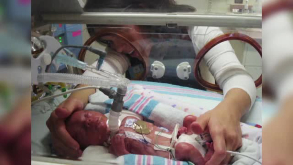 Medicii au spus ca nu va putea respira si ca este mut. Cum i-au schimbat operatiile soarta unui baietel din SUA