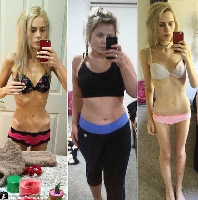 N-a mancat si n-a baut nimic o saptamana ca sa devina vedeta liceului. Cum arata adolescenta la 33 de kilograme