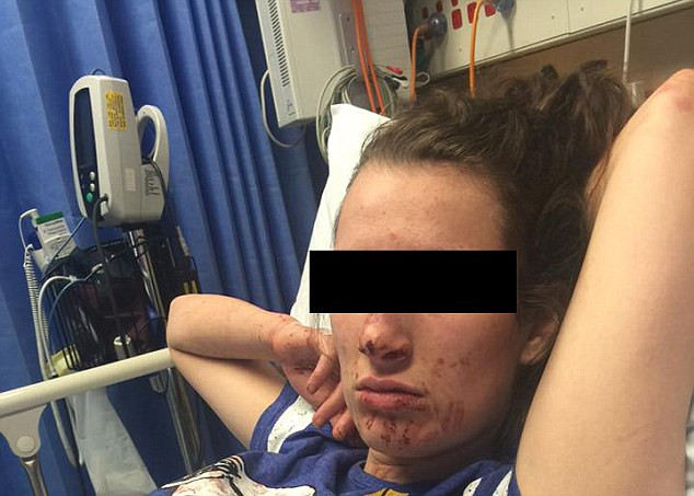 O tanara de 19 ani a ajuns desfigurata, dupa o cearta aprinsa cu iubitul. Imaginile au starnit revolta pe internet.FOTO