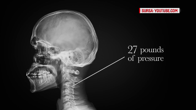 Stam cu ochii in telefon pana ni se schimba fizionomia. Chirurgii plasticieni ne arata "fața de smartphone"