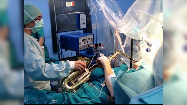 Muzician operat pe creier in timp ce canta la saxofon. Interventia, o premiera in Europa, a fost un succes