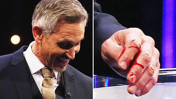 Varsare de sange in direct, la BBC. O vedeta s-a taiat intr-un premiu in timpul galei de decernare