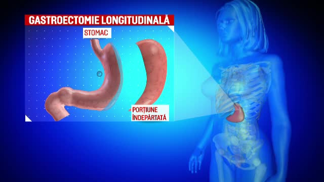S-a internat sanatoasa in spitalul in care lucra de 10 ani, iar dupa 5 operatii a murit. "Medicul zicea ca totul va fi bine"