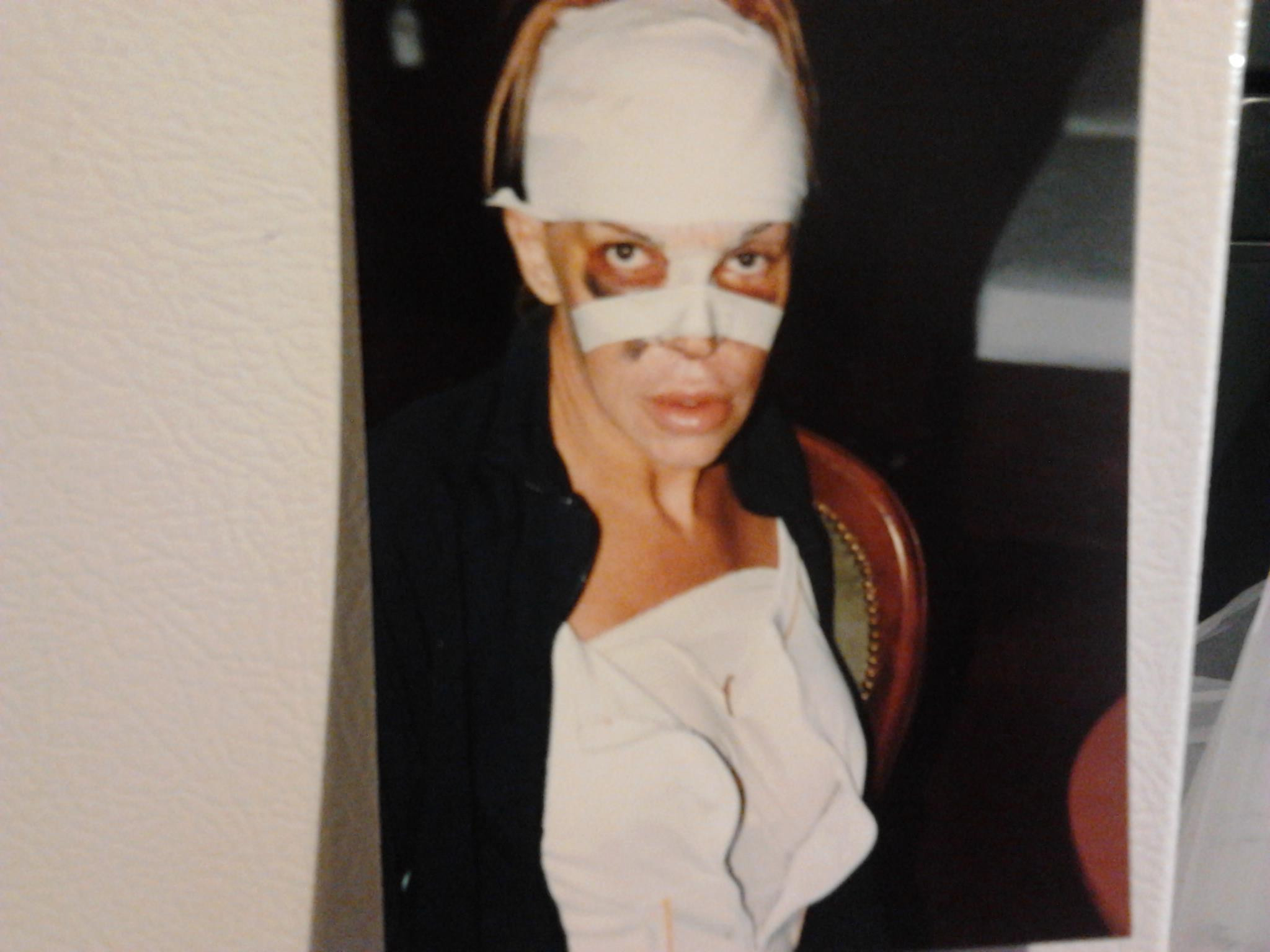 A cheltuit 52.000 de lire ca sa fie "perfecta". Cum a ajuns sa arate o transsexuala dependenta de operatii estetice