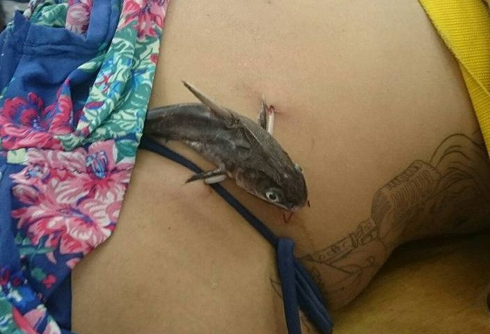 Un peste s-a infipt in stomacul unei inotatoare, in Brazilia. Imaginile facute de medici s-au viralizat