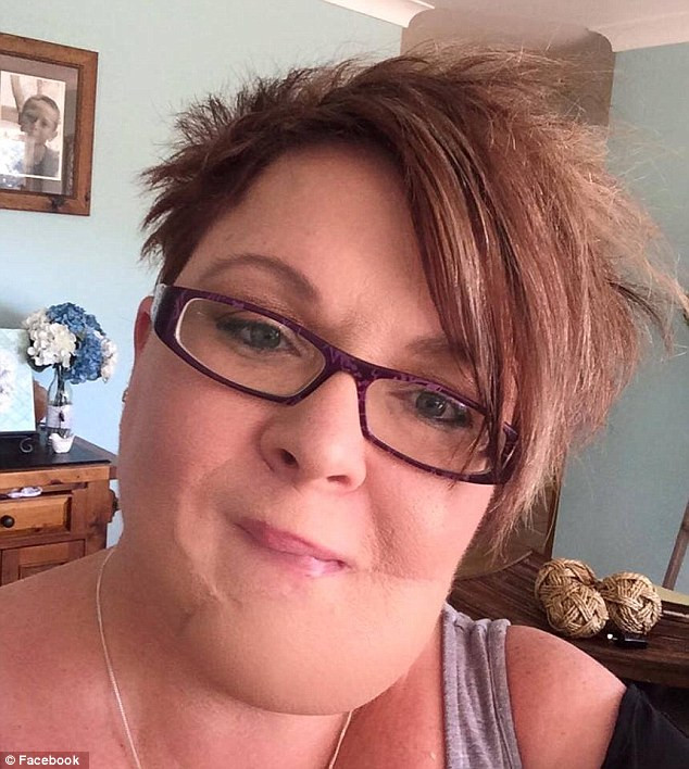 Experienta traumatizanta a unei femei care a crezut ca are in barba un simplu cos. Ce a descoperit dupa cativa ani. FOTO