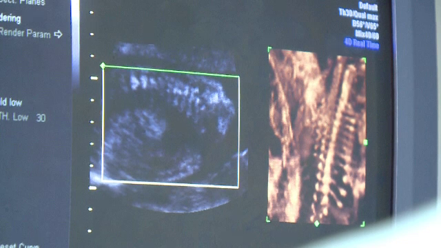Bebelus nascut cu malformatii grave, in Bucuresti, desi medicii au urmarit sarcina. "Parintii s-au speriat cand l-au vazut"