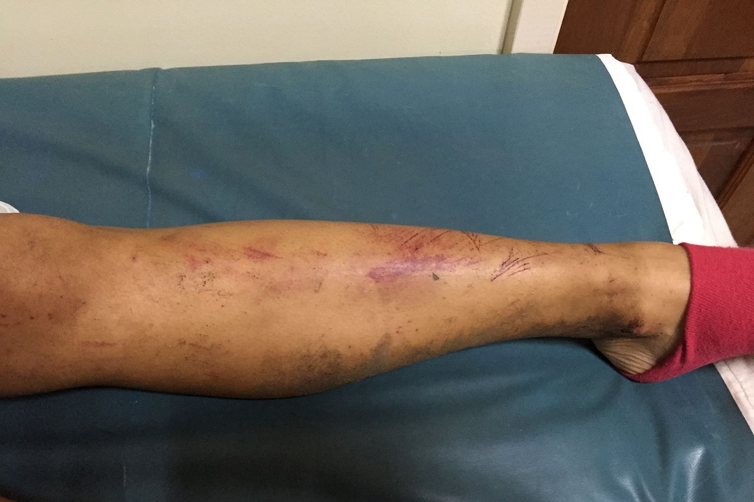 rapiti de canibali Papua Noua Guinee - 6