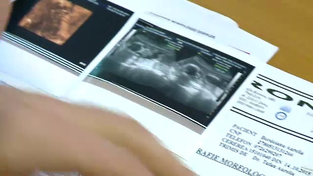 Drama femeii obligate sa duca la capat sarcina, desi va naste un bebelus cu multiple malformatii: "Ni s-a zis ca e in regula"