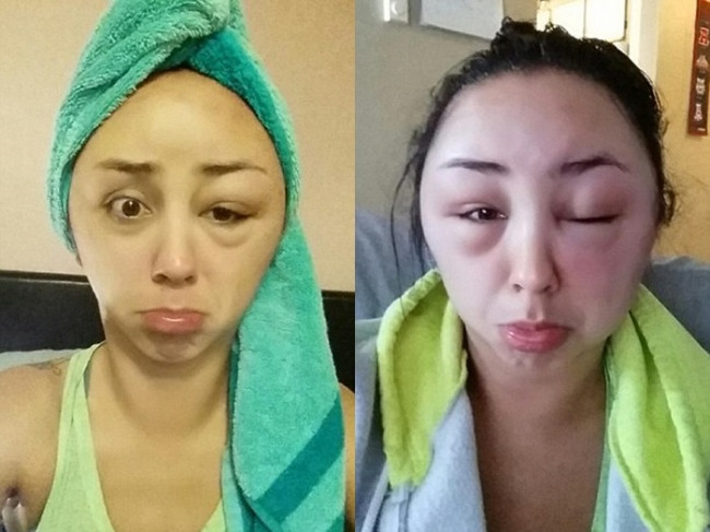 A vrut o schimbare de look, dar s-a ales cu o fata desfigurata. Cum a ajuns sa arate aceasta tanara dupa ce si-a vopsit parul