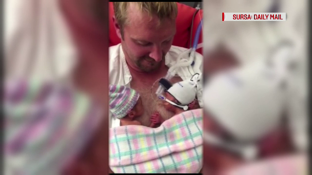 Abia s-au nascut, insa deja s-a format o legatura puternica intre ei. Imaginea cu gemeni care a ajuns viral