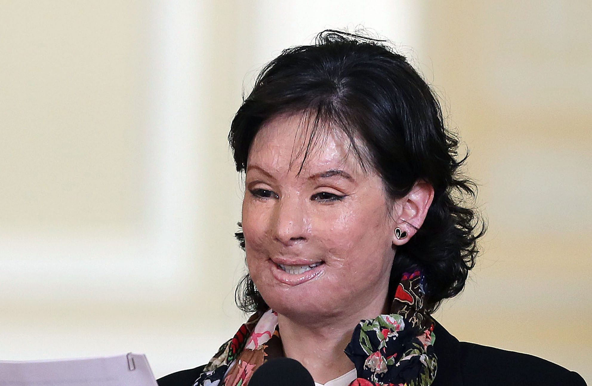 Cazul ei a schimbat legile in Columbia. Tanara desfigurata cu acid acum 2 ani a iesit pentru prima data in public, fara masca